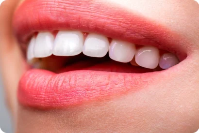 Hollywood Smile