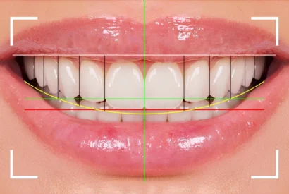 Zirconium Crowns